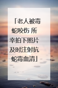 老人被毒蛇咬伤 所幸拍下照片及时注射抗蛇毒血清